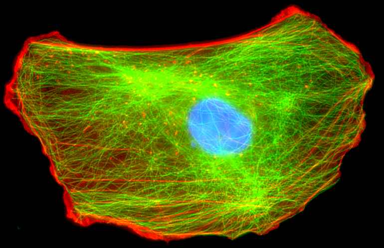 cytoskeleton